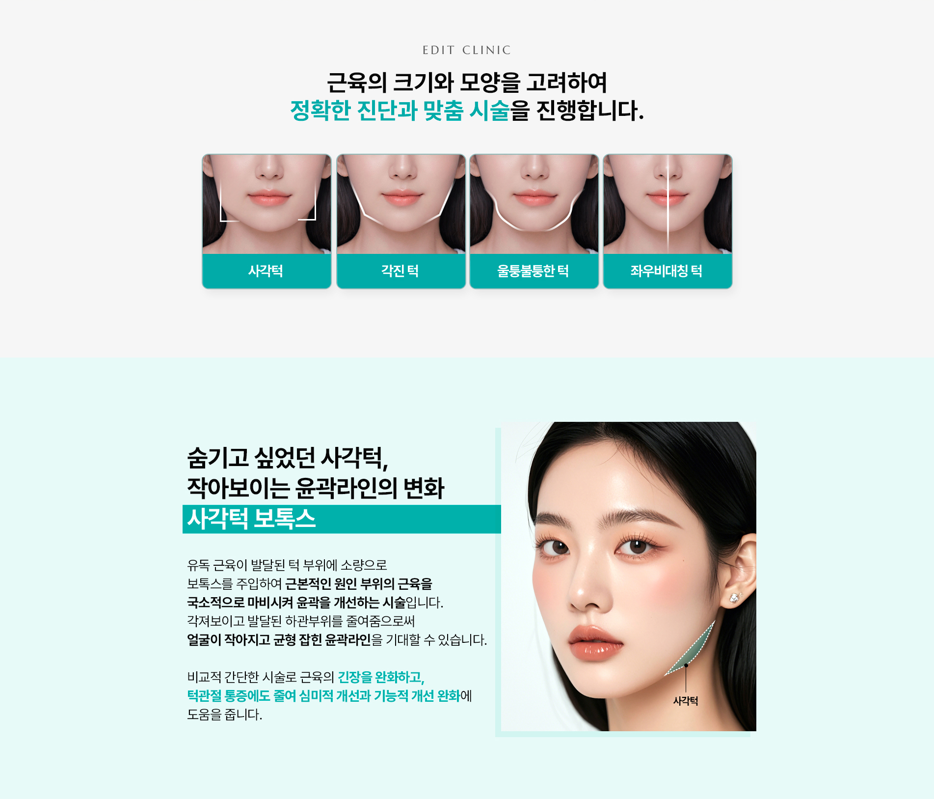 사각턱보톡스2