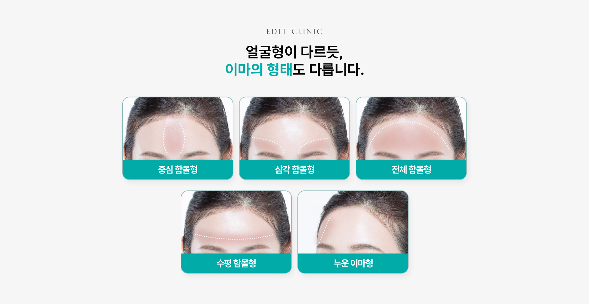 이마/관자필러 02