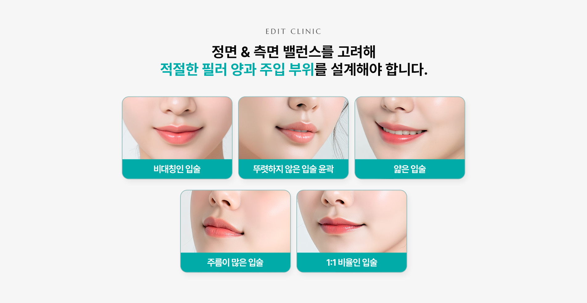 입술필러 02