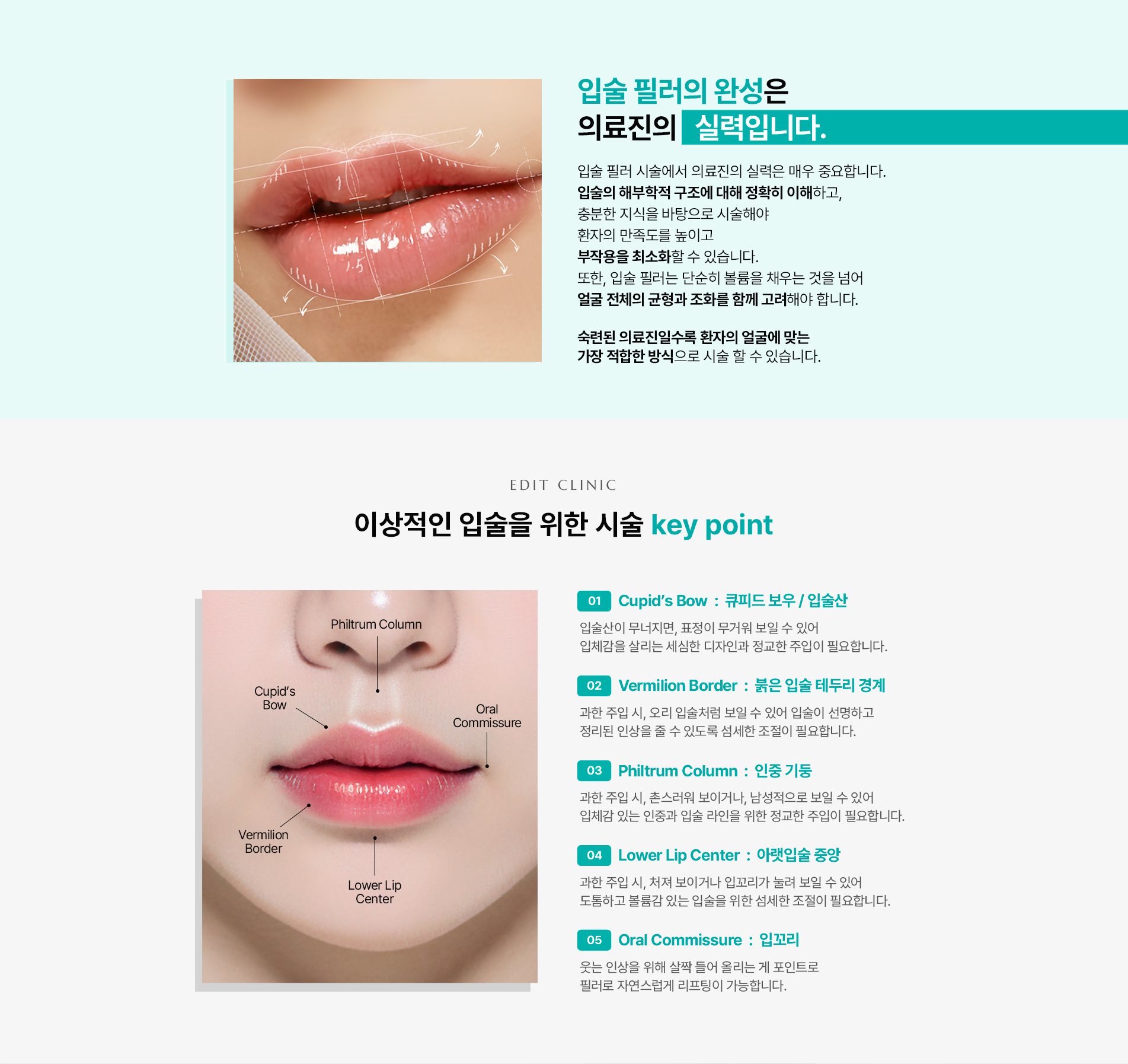 입술필러 03