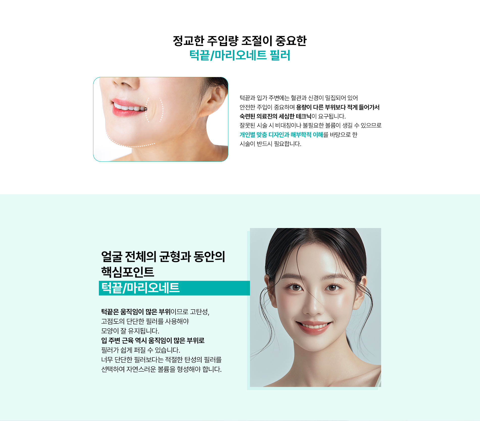 턱끝,마리오네트 포인트