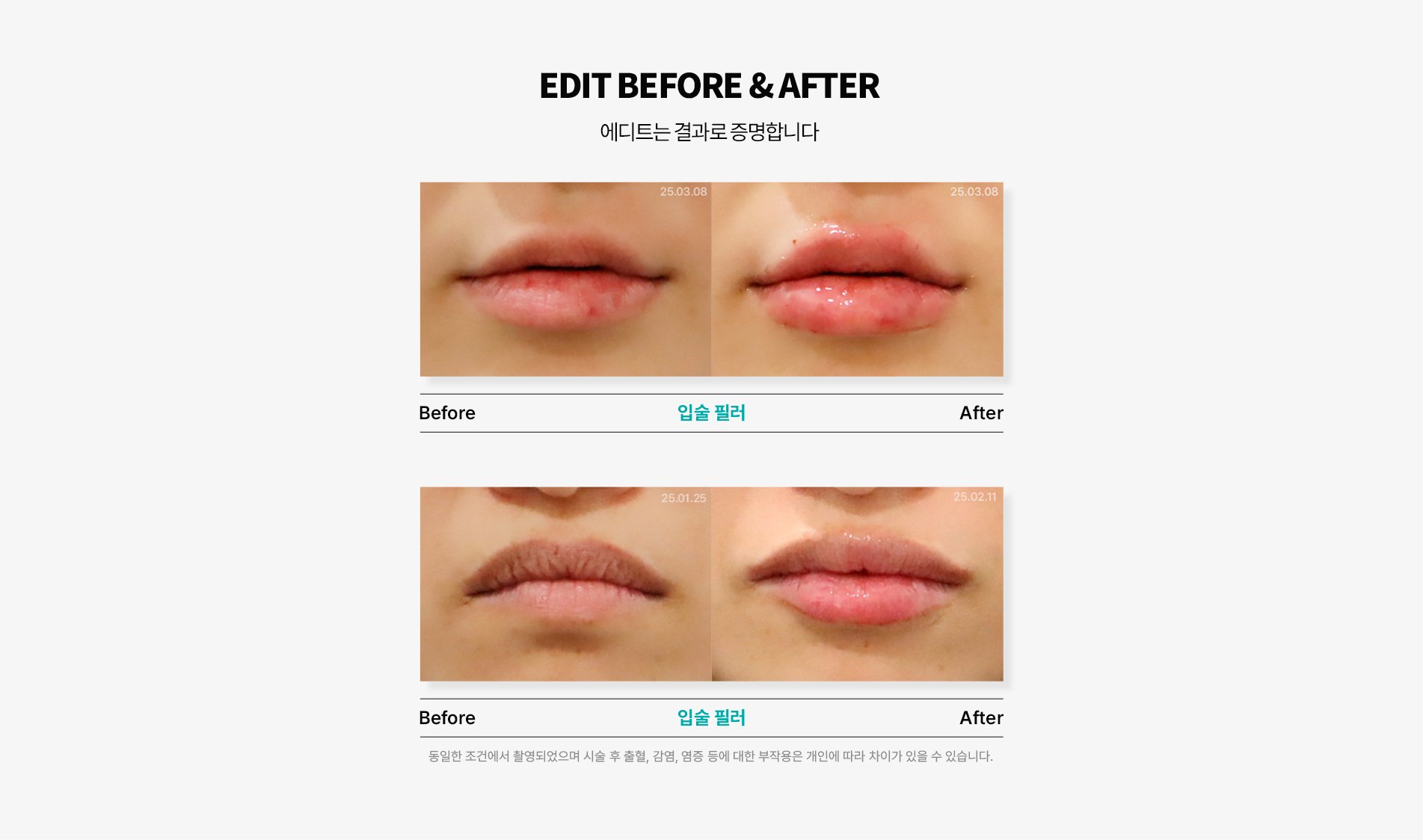 전후사진