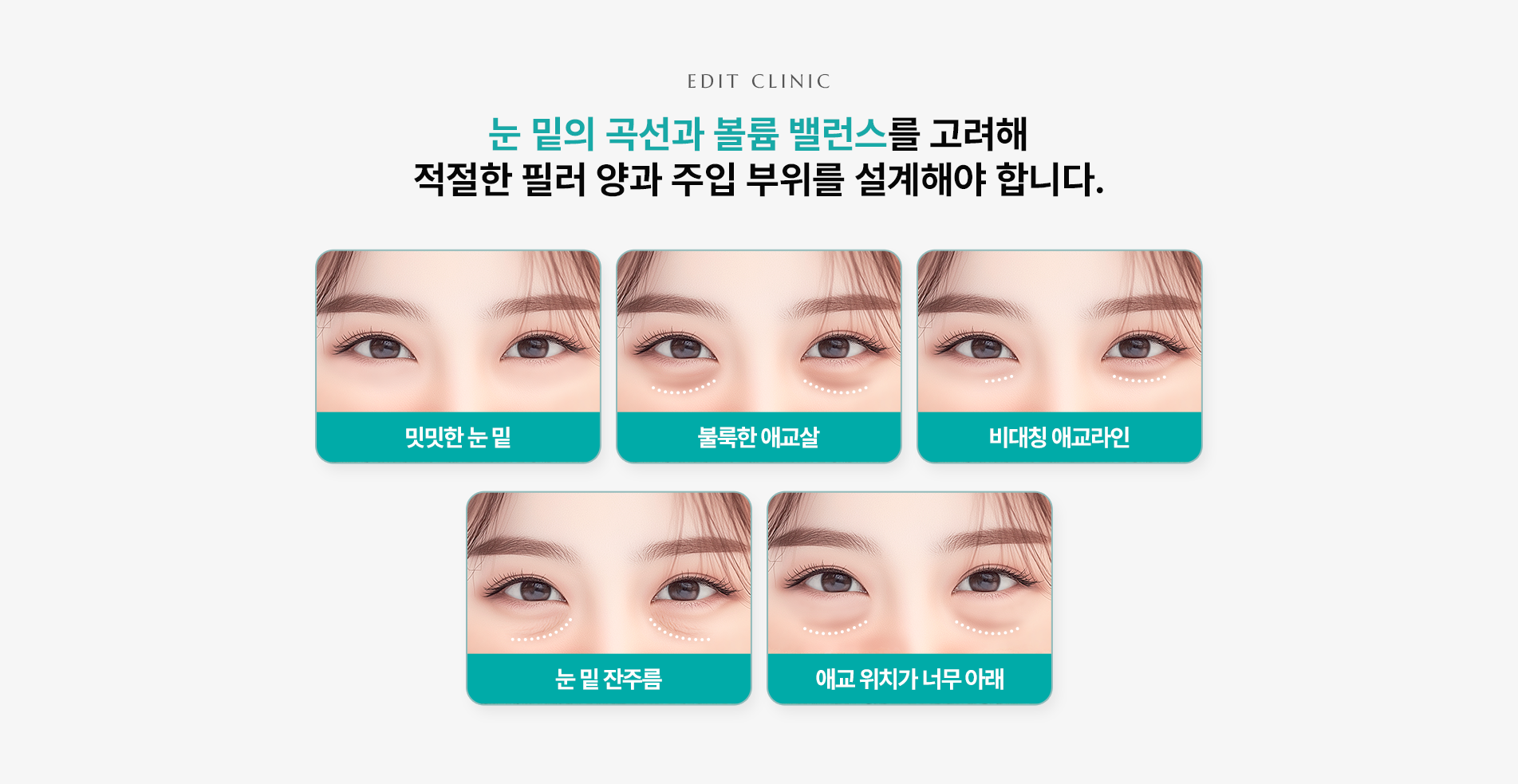 애교필러 시 고려사항