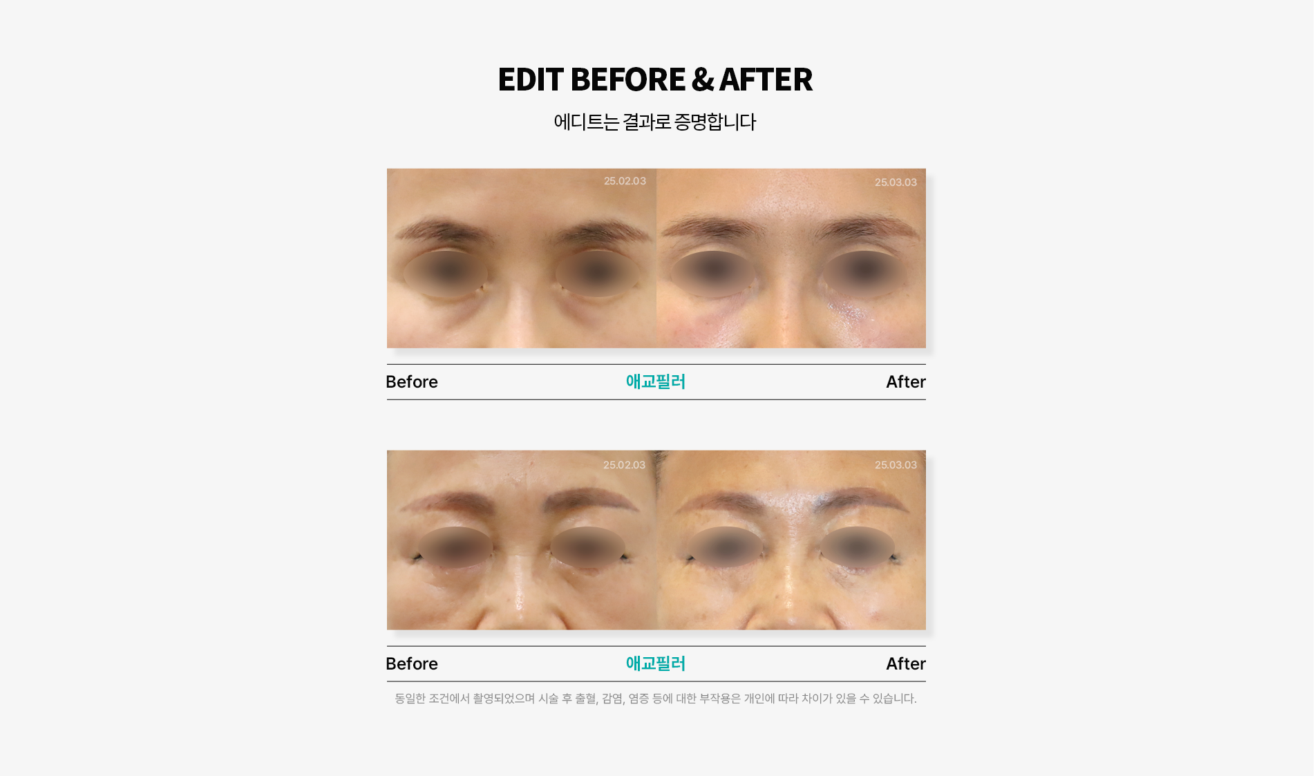 전후사진
