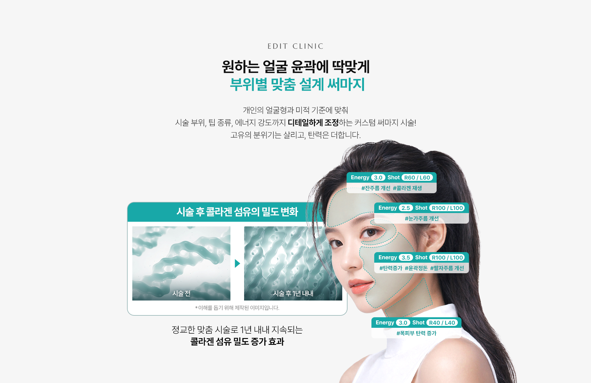 히트레디써마지 부위별 맞춤 설계