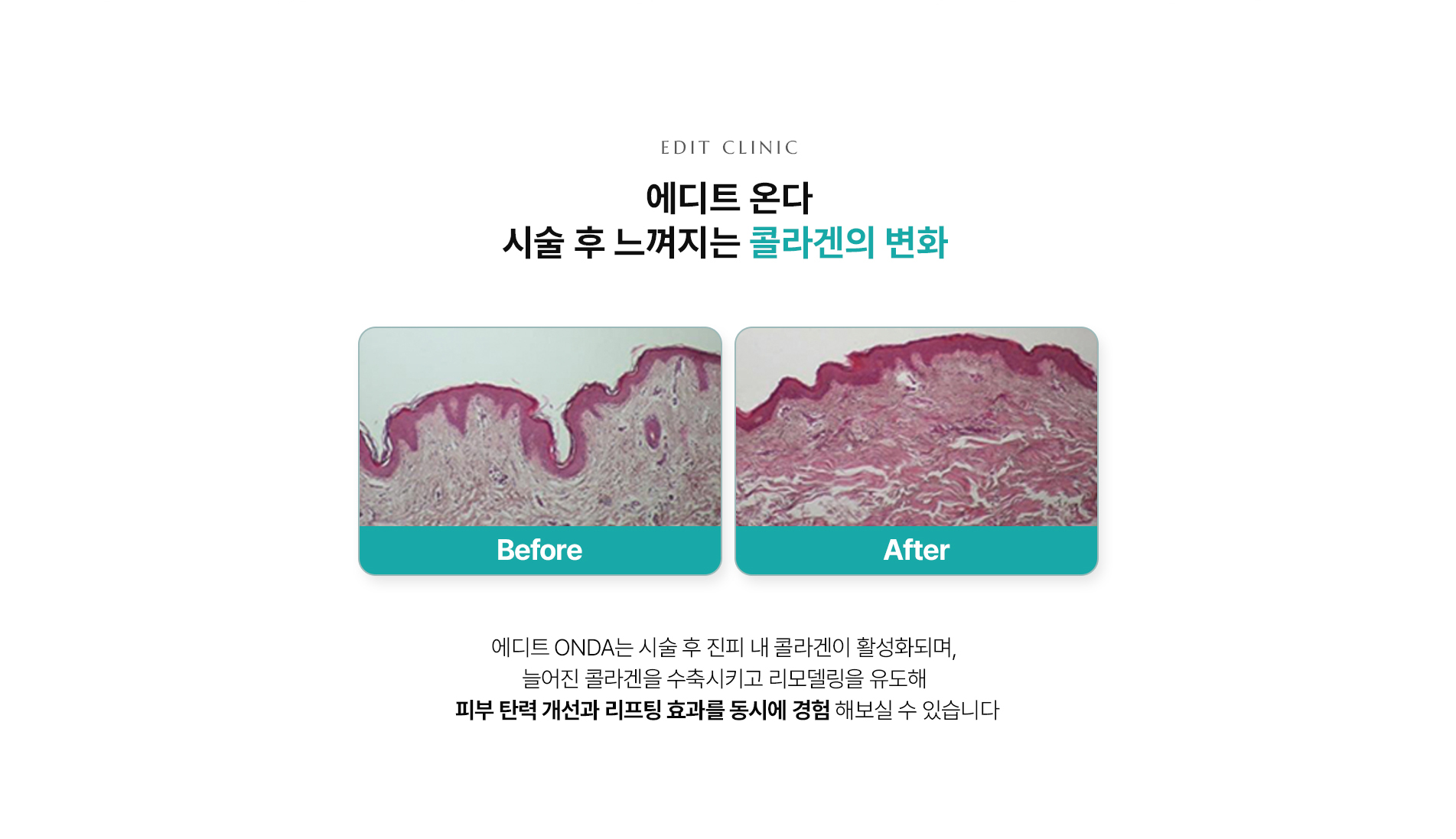 온다07
