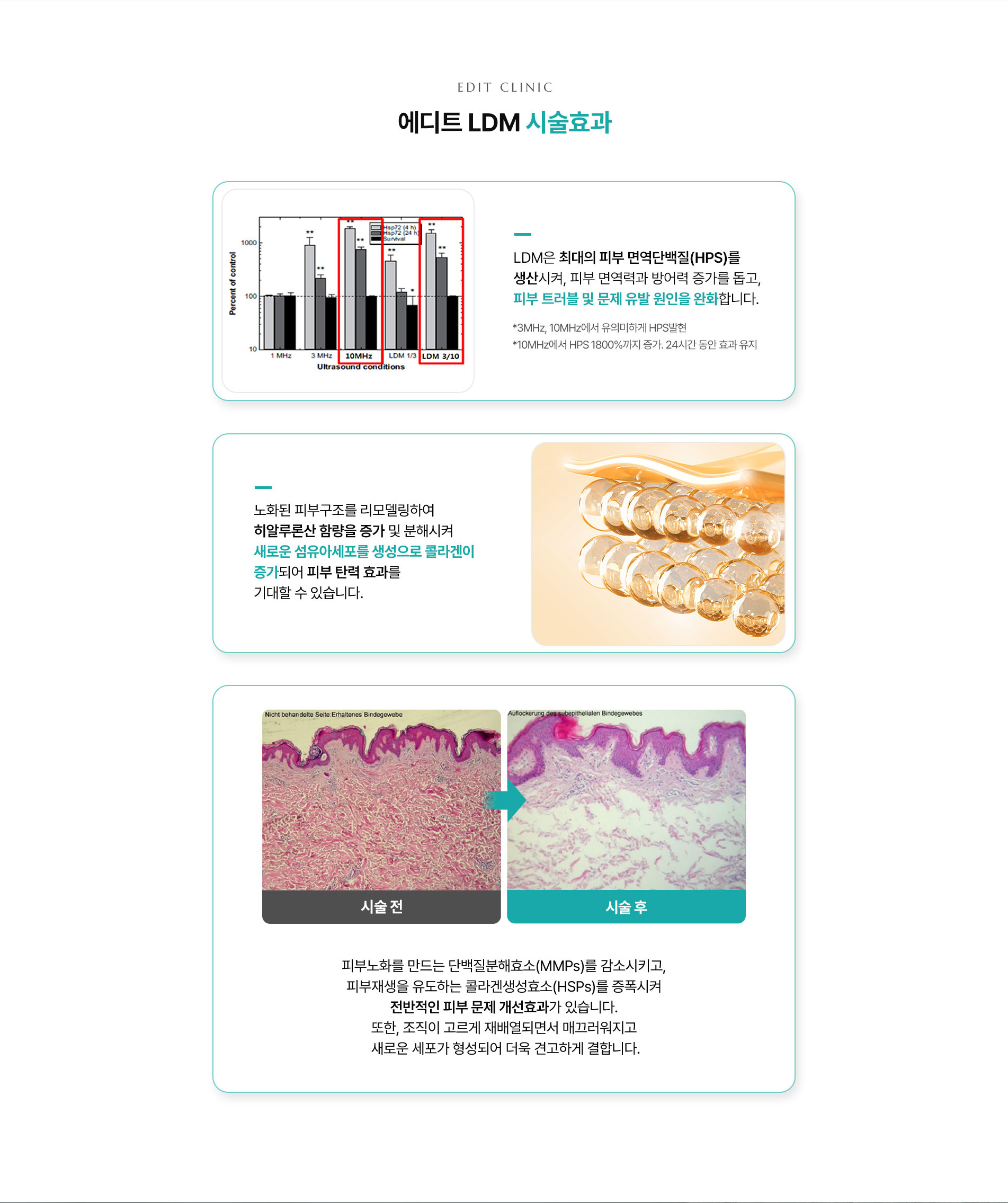 ldm 04
