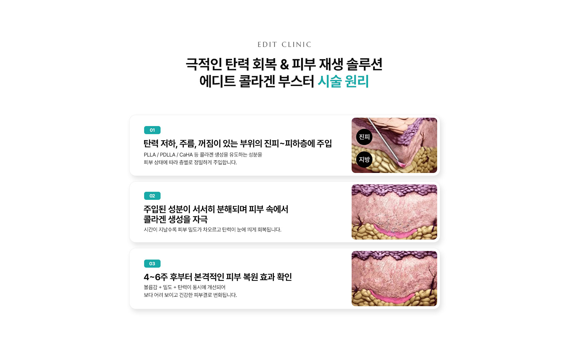 콜라겐부스터 시술 원리