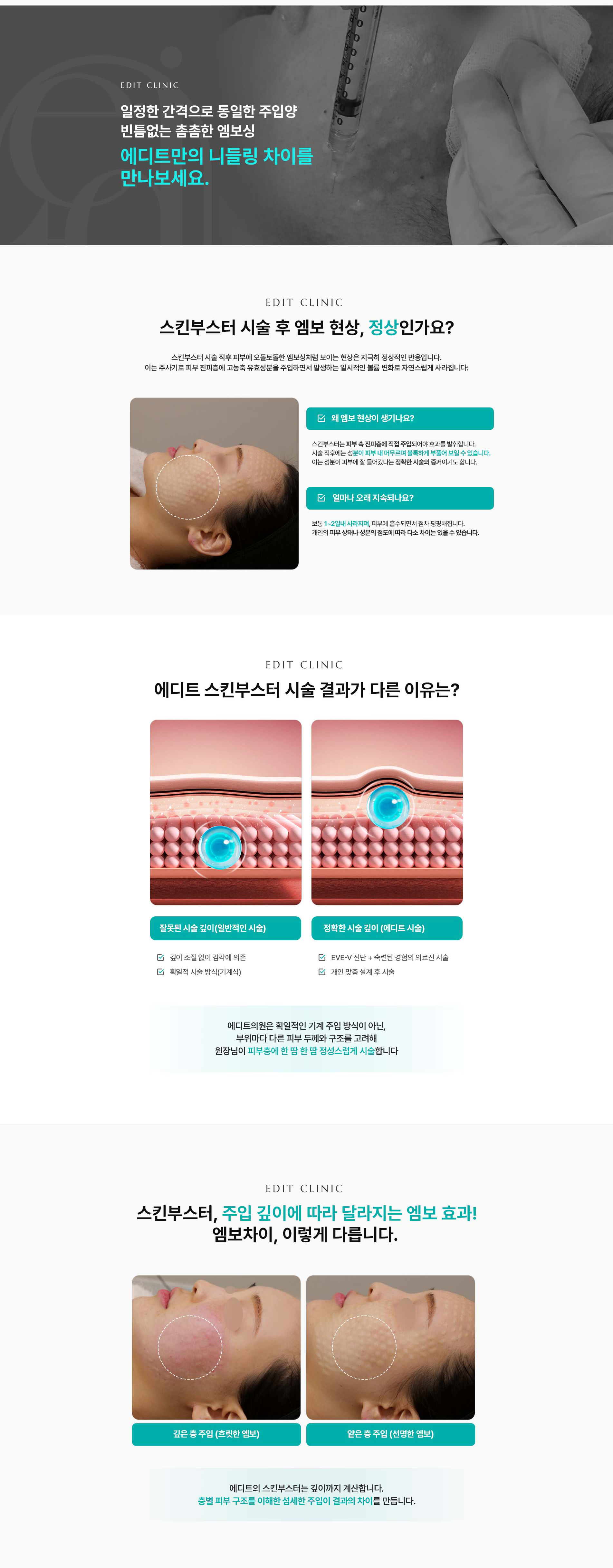 가장 쉬운 방법