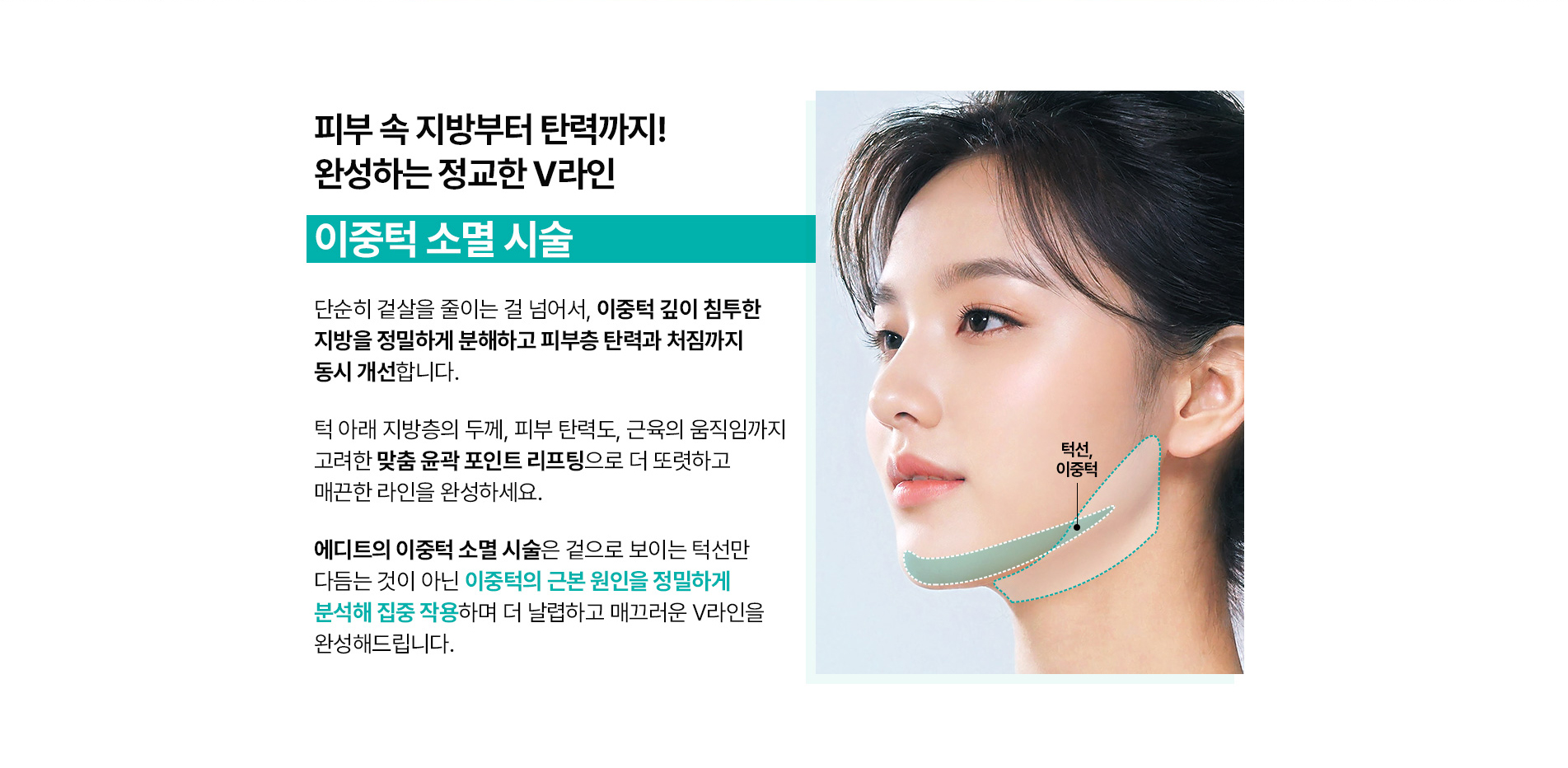이중턱 소멸 시술